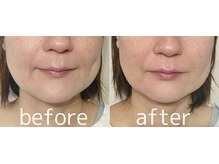 ララスマイル 鶴崎森町店/不眠 頭痛 眼精疲労 肩こり 整体