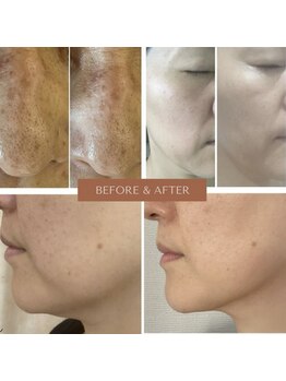 ヘルシーアンドビューティー でわ/