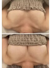 スマイルクルー(SmileClue)/ビフォーアフター症例