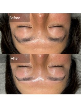 ニューミー(NEW ME)/加古川メンズ眉毛/眉毛デザイン