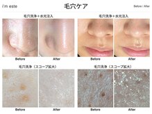アイムエステ 平塚店(i'm este)