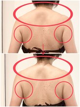 ビフォート(BEFORT)/1回での結果です！