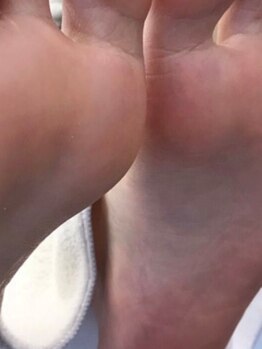 タイガー(tiger)/フットケア