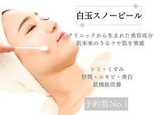 シェリー(CHERIE)の雰囲気（【シミ・くすみケアには白玉スノーピール】1度で驚きの効果実感）