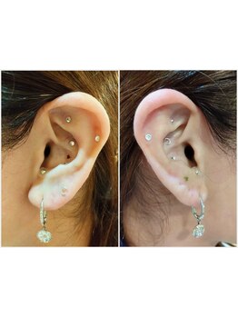 小顔になりたい