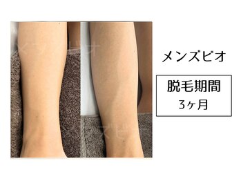 メンズビオ 神戸三宮店/