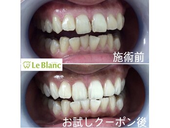 ルブラン 奈良店(Le Blanc)/効果が期待できる当店のお試し