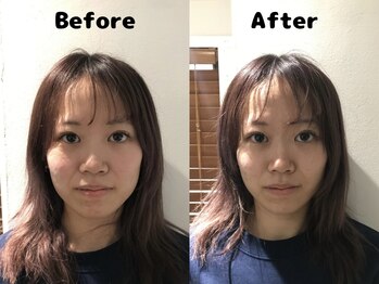 くにたちNyan鍼灸整体院/【小顔矯正】Before After 4