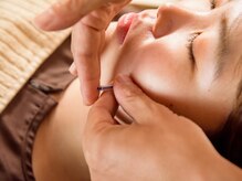 キート美容鍼灸 整体院(Kiito美容鍼灸 整体院)/美容鍼１