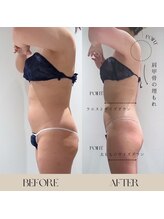 インフィニーズ(INFINEEZ)/カスタス120分ポールシェリー