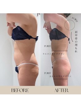 インフィニーズ(INFINEEZ)/カスタス120分ポールシェリー