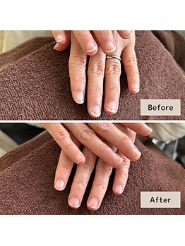 マニュキュア(Manicure)/爪トラブルの根本的なお悩みに