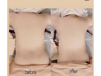 ルルアス(LuLuAS)/背中インディバ