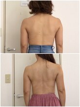 ヴィノス 京都烏丸店(vinos)/背中もスッキリ！