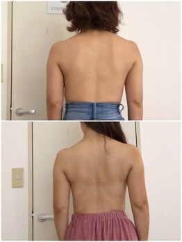 ヴィノス 京都烏丸店(vinos)/背中もスッキリ！