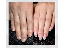 サロンドエヌ(Salon de N)/結婚式等期限が決まっている方も