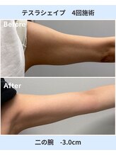 アーヒル 富山店(A”-HILU)/