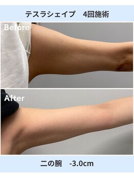 アーヒル 富山店(A”-HILU)/