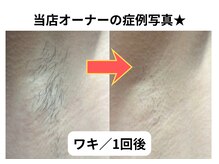 NTエステティック 西条店/