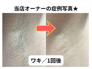 NTエステティック 西条店/
