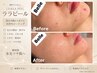 【9月末まで限定★韓国肌管理】ララピール|ツヤ・毛穴・くすみケア¥6,280