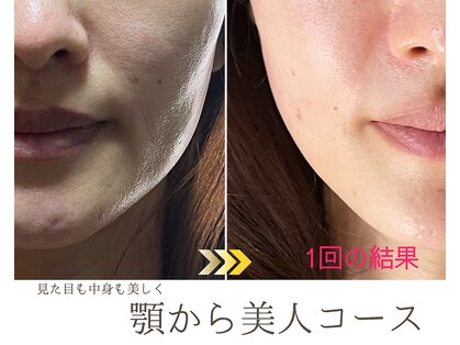 バックステージ鍼灸院(Backstage鍼灸院)の写真