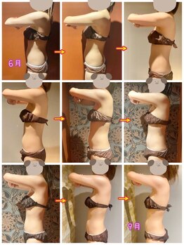 サンタイ(santai.)/Wキャビ/深層リンパ