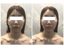 美極 トータルビューティー(美極 TOTAL BEAUTY)/恵比寿/小顔コルギ/エステ