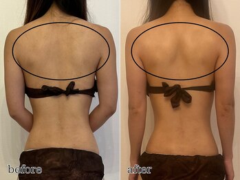 エビアス(Evias)/辛い肩こりから解放されたい