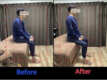 オータム(Autumn)/巻肩、猫背も全身調整