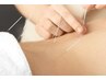 【鍼灸＋マッサージ】上半身or下半身を鍼の力で根本改善！¥6600→¥4950