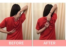 北浦和整体院/肩甲骨はがしで驚きの変化！