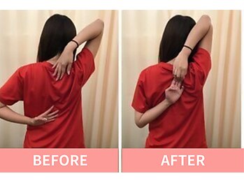 北浦和整体院/肩甲骨はがしで驚きの変化！