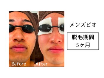 メンズビオ 神戸三宮店/