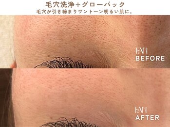ファン(FAN)/グローパック BEFORE-AFTER