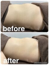 ギンザアール(GINZA R.)/ぽっこりお腹に徹底アプローチ◎