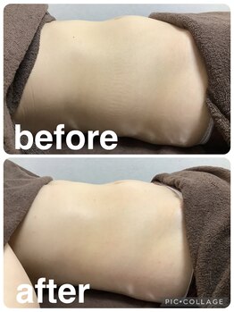 ギンザアール(GINZA R.)/ぽっこりお腹に徹底アプローチ◎