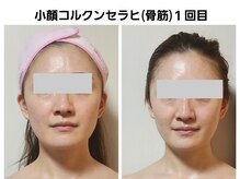 セレブリティ(Celebrity)