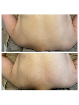 美温(mion)/疲労回復ケア