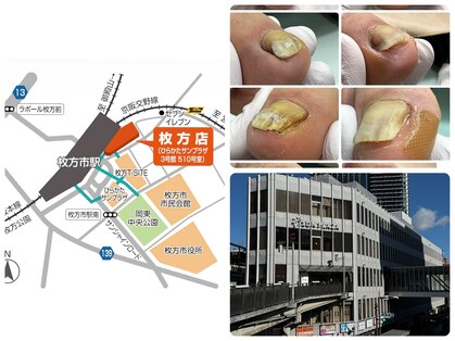 巻き爪補正店 枚方店【2/21 NEW OPEN(予定)】の写真