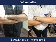 ランドマーク 中崎町(LANDMARK.)/《 腕 》