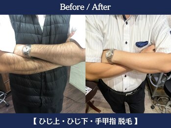 ランドマーク 中崎町(LANDMARK.)/《 腕 》