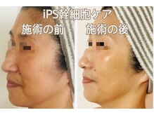 れふぇるん 足利店