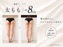 ビオール 池袋店(beall)の雰囲気(2ヶ月でマイナス8センチ★ビオールオリジナルセルライトケア)