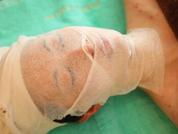 フィオーレ(Fiore)/小顔フェイシャル★★