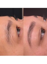 サラモ(Sa La Mo)/光脱毛