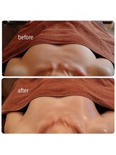 リラムーン(Relamoon)/バザルト【メリハリ美ボディ】