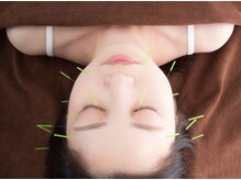 りらっと/ほうれい線/目の開き/二重顎