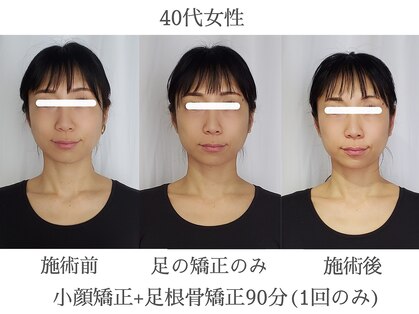 エクラ(eclat)の写真