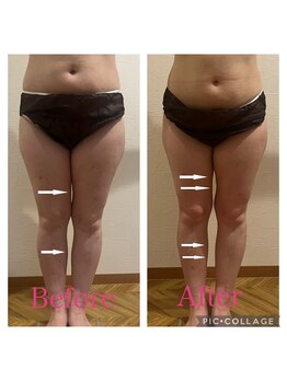 ヨサパーク アミカル 八幡山店(YOSAPARK amical)/水素も同時で下半身すっきり♪